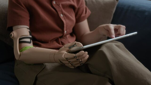Cheerful kid with arm prosthesis watching videos online on tablet
