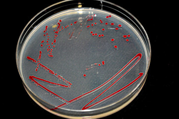 Petri dish with red colony of bacteria