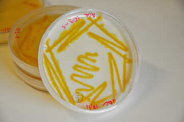 Orange colonies of bacteria on agar plate