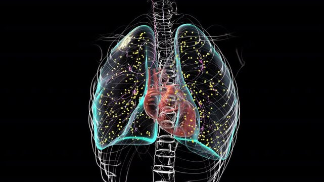 Lung miliary tuberculosis, a disseminated form of tuberculosis characterized by numerous tiny lesions scattered throughout the lungs, 3D animation.