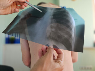 Doctor diagnoses patient's health condition for asthma, lung disease