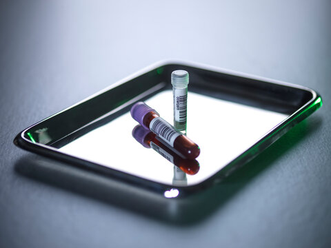 Blood and DNA samples in vials on a metal tray used for medical testing and pharmaceutical research.