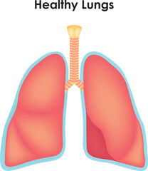 Lungs Tumor Trachea Superior Lobe Bronchi Tumor Inferior Lobe Middle Lobe Left And Right Lobe Science Vector Illustration