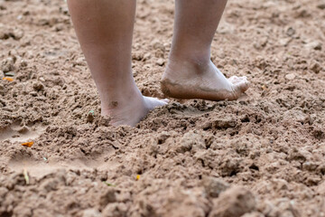 Closeup barefoot walking on sand floor of patient after recovering from hospital to treat body balance and alternative medical treatment of people after surgery, soft focus.