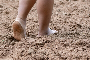 Closeup barefoot walking on sand floor of patient after recovering from hospital to treat body balance and alternative medical treatment of people after surgery, soft focus.