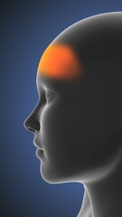 Medical concept of head ache