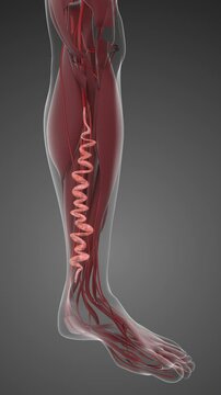Varicose Veins, Venous Insufficiency And Vascular Disease Concept