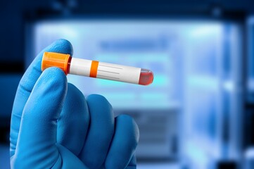 Hand hold test tube for blood sample