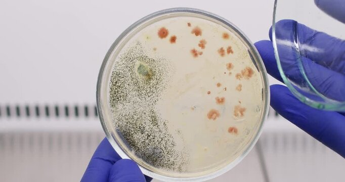 A scientist opens a petri dish where bacteria and black mold have grown. Analysis of bacterial growth in mold contamination.