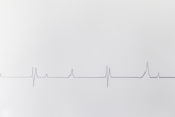A white background with a line that looks like a heartbeat