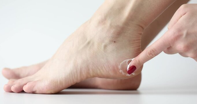Applying moisturizer to dry heels on white background