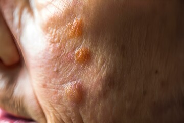 Fototapeta premium 色素沈着のある成熟した女性の肌のクローズアップ、コピースペース｜Close up of mature woman skin with hyperpigmentation. Copy space.