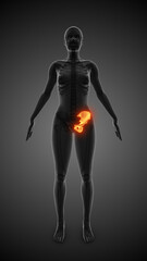 Medical animation of the hip bone pain