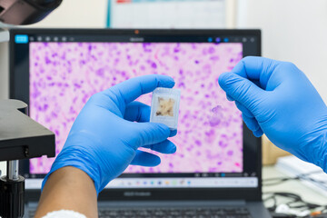 Scientist wear blue glove holding parafin human tissue block and out of focus computer monitor show...