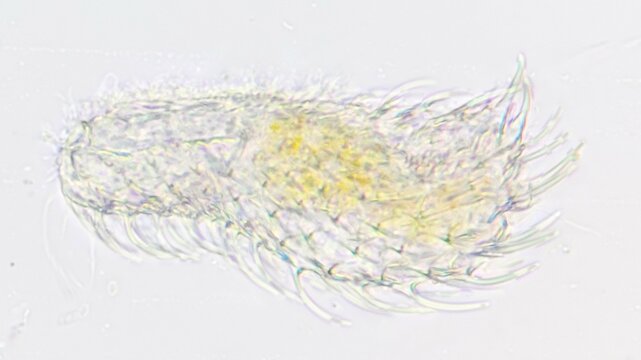 Acoelomate gastrotrichs, Chaetonotus sp. Fresh sample. Selective focus image