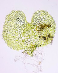 Fern gametophyte under microscope. Fresh sample without staining. Selective focus image