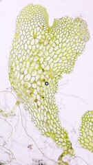 Fern gametophyte under microscope. Fresh sample without staining. Selective focus image