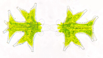 Early stages of Micrasterias mahabuleshwarensis vegetative reproduction by cell division. Live...