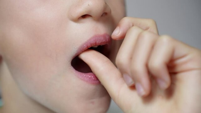 Child touching loose baby tooth, close-up. Baby teeth are replaced by permanent teeth. Children's dentistry, dental care. 
