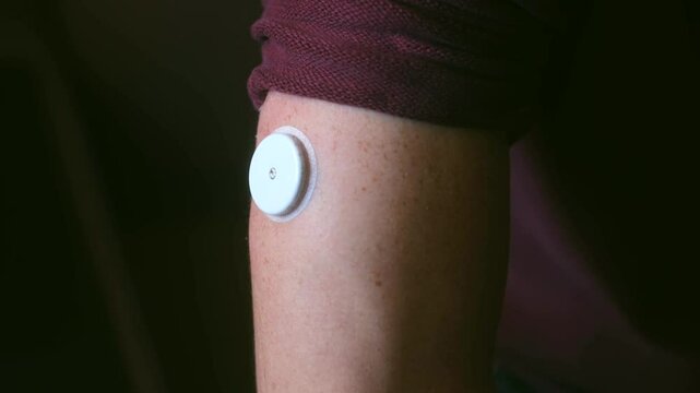Person is wearing a continuous glucose monitoring system patch on their upper arm, providing real-time blood sugar readings for diabetes management