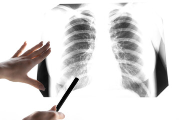 A snapshot of the lungs. Fluorography. X-ray shows lungs with pneumonia. Chest x-ray into the lumen on a white screen. Ribs and lungs in x-ray. Coronavirus. A symbol of a healthy lifestyle.
