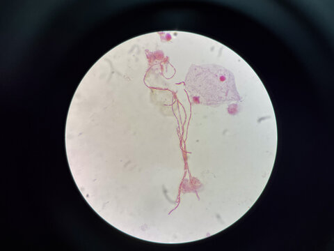 Bacteria cell in hemp culture