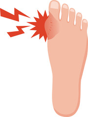 足の痛みと腫れのイラスト