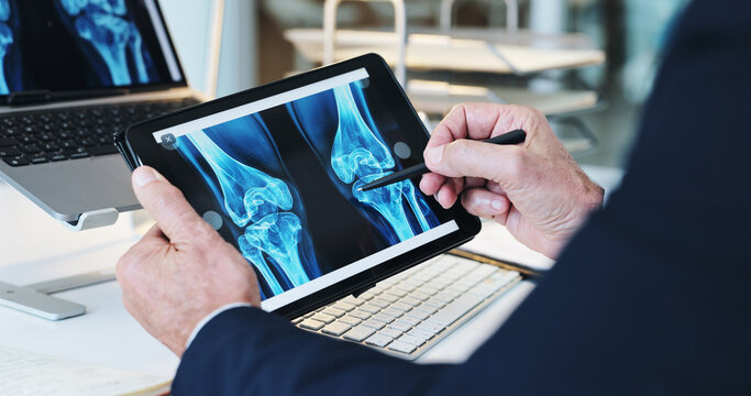 Hands, bone scan and tablet screen for patient record for healthcare or examination with xray. Doctor, male person and technology for MRI results, injury or illness as orthopedic or medical condition