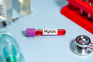 Obraz premium Blood collection tubes Mpox test positive results,WHO to rename monkeypox as ‘Mpox’