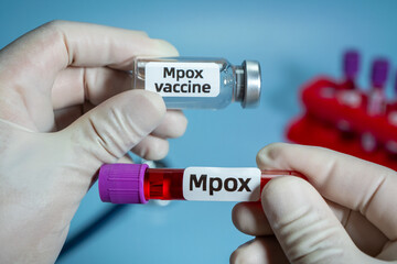 Blood collection tubes Mpox test positive results,WHO to rename monkeypox as ‘Mpox’