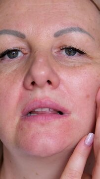 Portrait the fingers holding the flabbiness adipose sagging skin, Flabby skin and loose, swelling and ptosis beside the eyelid, dark spots and wrinkle on the face, health care and beauty concept.