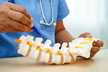 Asian doctor holding spinal nerve and bone model, Lumbar spine displaced herniated disc fragment for treatment medical in the orthopedic department.