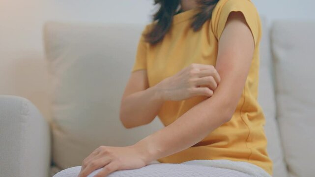 woman itching and scratching itchy arm. Sensitive Skin Allergic reaction to insect bite, food, drug dermatitis. Dermatology, Leprosy day, Systemic lupus erythematosus, Allergy symptoms and rash Eczema