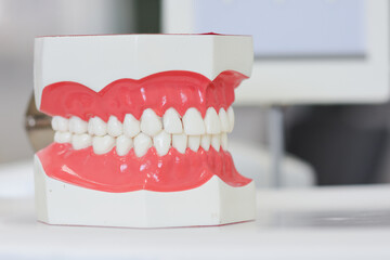 Modern denture model in dental laboratory