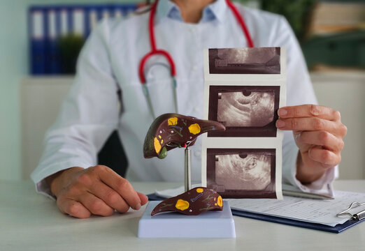 Ultrasound diagnosis of stomach and liver on abdominal cavity of in clinic