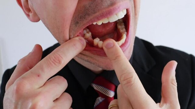 boca faltando dente 