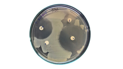A culture plate of Staphylococcus aureus (S.aureus) on Mueller-Hinton agar (MHA) to test for antibiotic resistance.