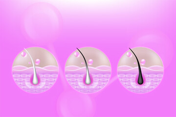 Hyaluronic acid and Niacinamide before and after gray hair and skin solutions ad, pink collagen serum drops into skin cell with cosmetic advertising background ready to use, illustration vector.