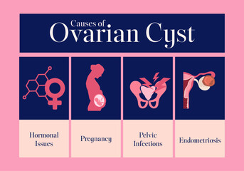 female reproductive system cause of ovarian cyst consist of illustration