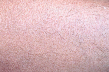 dry and dehydrated human skin texture background