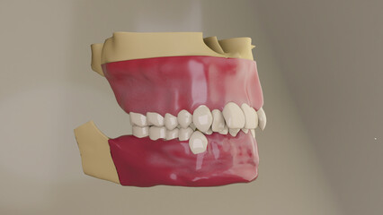 Orthodontic pre treatment
