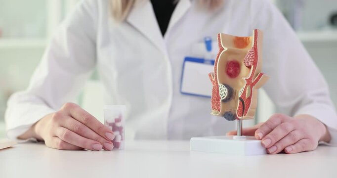 Doctor explains anatomy of human rectum and holds pills