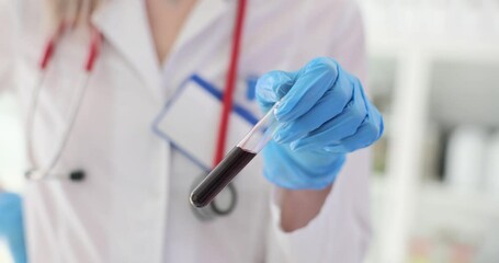 Doctor holds a blood sample in test tube closeup