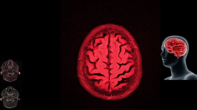 Magnetic resonance imaging of the brain. MRI of the brain. Medical examination of the human brain. Coronal brain MRI for diagnosis of neurological disorders