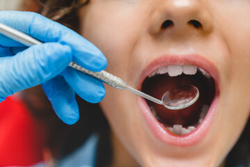 Close up cropped shot of kid`s child opened mouth while visiting dentist orthodontist, checkup of baby teeth in dental clinic