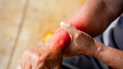 Fototapeta premium person gently holds their wrist, possibly indicating pain or discomfort, with focus on hands and skin texture. background is softly blurred, highlighting subject