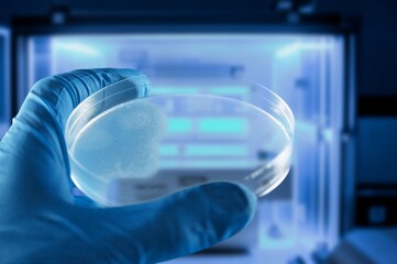 Scientist holding plate for diagnosis bacterial at laboratory.