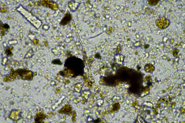 microorganisms and soil biology, with nematodes and fungi under the microscope. in a soil and compost sample