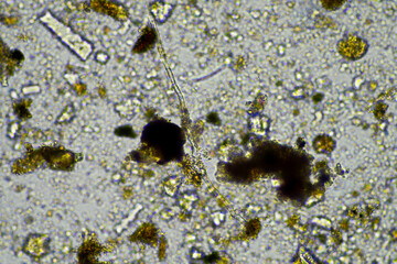 microorganisms and soil biology, with nematodes and fungi under the microscope. in a soil and...