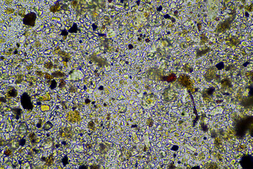 microorganisms and soil biology, with nematodes and fungi under the microscope. in a soil and compost sample